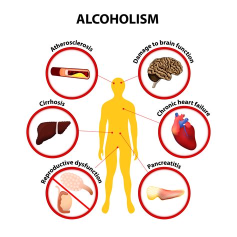 A Painful Reality: Examining the Devastating Effects of Alcohol Addiction on Physical Health